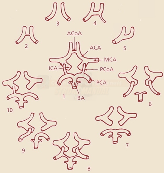 The Circle of Willis - variants