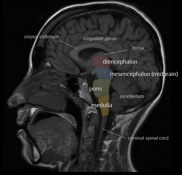 Brainstem anatomy on MRI